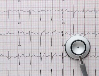 Боли в области сердца: ЭКГ как основной метод диагностики